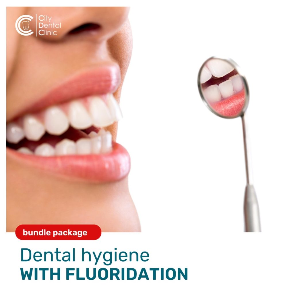 dental-hygiene-with-fluoridation-cityclinic-eu